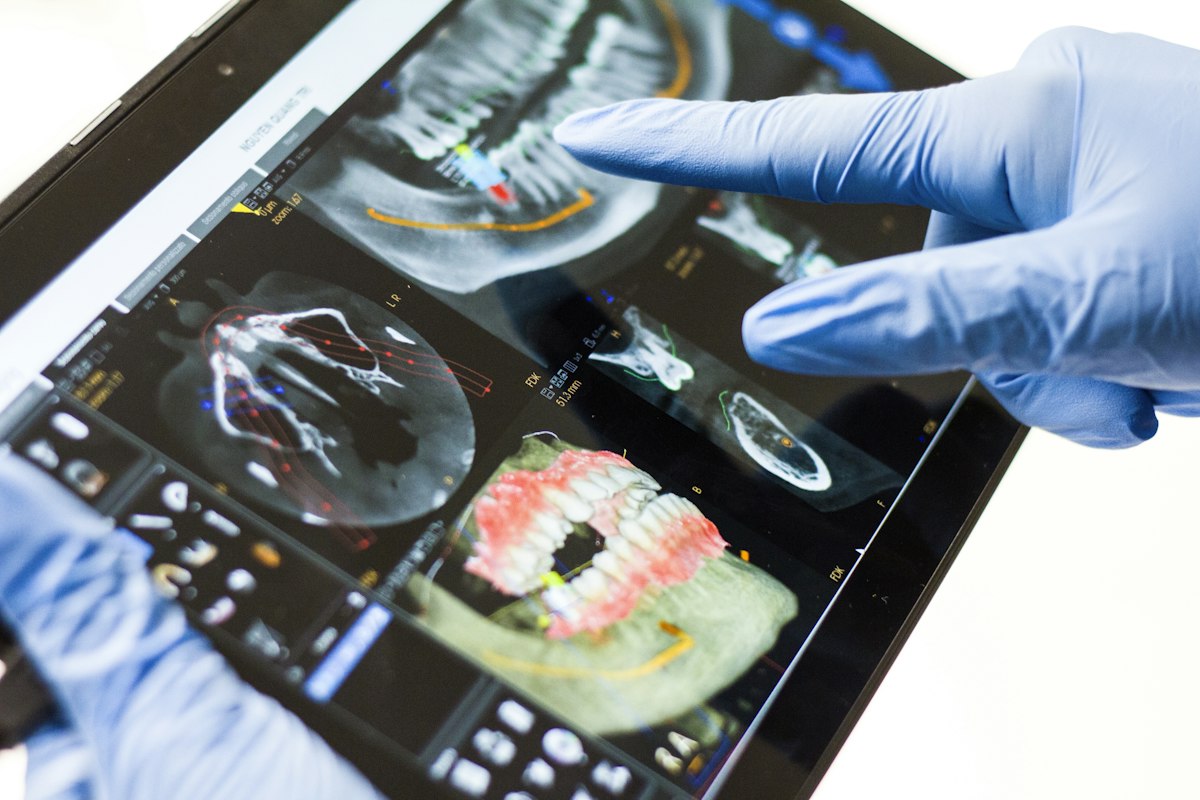 A dental scan shown on a tablet